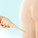 携帯おしり洗浄器セット